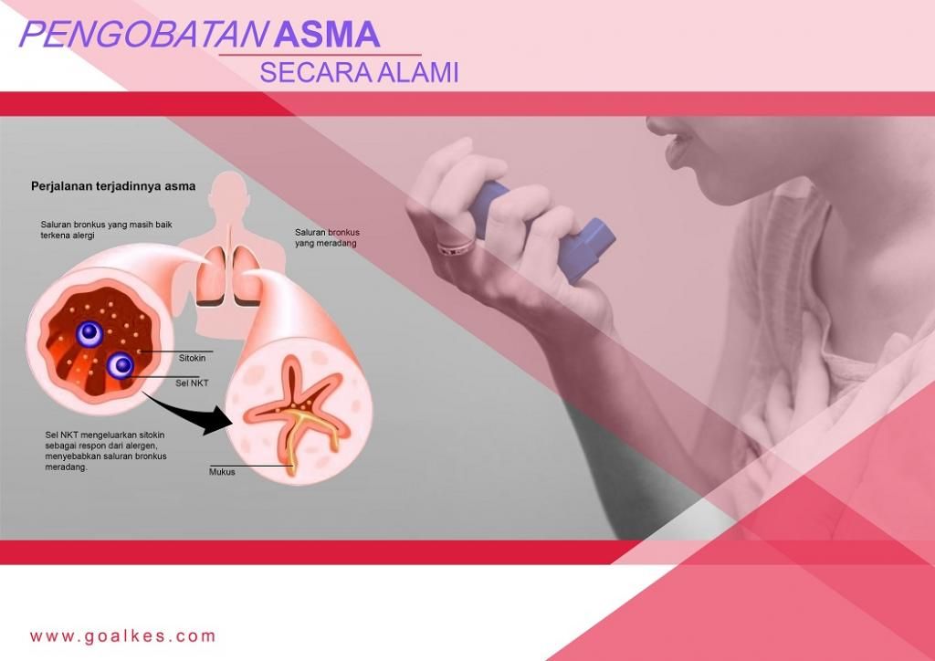 Pengobatan Asma Secara Alami